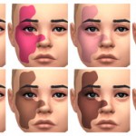 Face Birthmark by Simsinmypocket